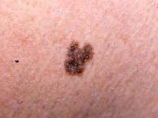 Mole